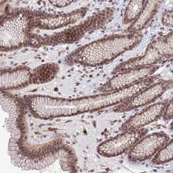 anti-TPRX1, Polyclonal, Novus Biologicals 0.1mL; Unlabeled:Antibodies,
