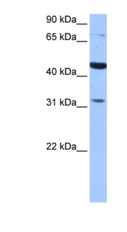 TPRXL Antibody, Novus Biologicals:Antibodies:Primary Antibodies
