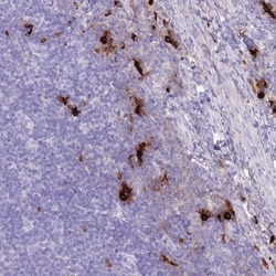 Tryptase beta-2/TPSB2 Antibody, Novus Biologicals 25 &mu;L | Buy Online | Novus Biologicals | Fisher Scientific