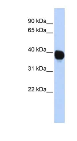 Tyrosylprotein Sulfotransferase 2/TPST2 Antibody, Novus Biologicals 0.05mg;