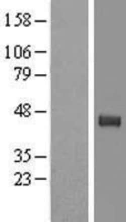 Novus Biologicals™ Tyrosylprotein Sulfotransferase 2/TPST2 Overexpression Lysate