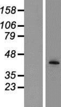 Novus Biologicals&trade;&nbsp;Tyrosylprotein Sulfotransferase 2/TPST2 Overexpression Lysate
