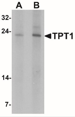 TPT1/TCTP Antibody - BSA Free, Novus Biologicals:Antibodies:Primary Antibodies