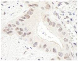 TPX2 Antibody, Novus Biologicals 0.1mg; Unlabeled:Antibodies, Polyclonal