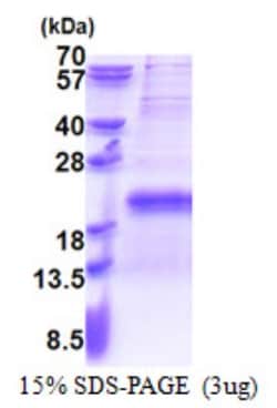 Novus Biologicals&trade;&nbsp;Recombinant Human TR2IT1 His Protein