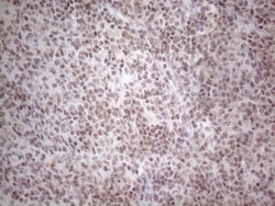 TR4/NR2C2 Antibody (OTI4B1), Novus Biologicals 0.1mL; Unlabeled:Antibodies,