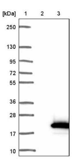 TRA16 Antibody, Novus Biologicals 25 &mu;L, Unlabeled:Antibodies, Polyclonal