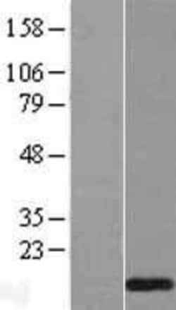 Novus Biologicals&trade;&nbsp;TRA16 Overexpression Lysate