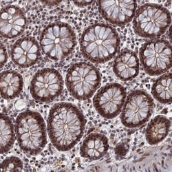 TRA16 Antibody, Novus Biologicals 25 &mu;L, Unlabeled:Antibodies, Polyclonal