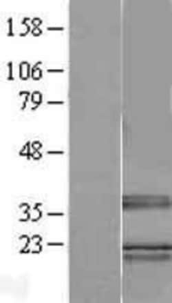Novus Biologicals&trade;&nbsp;TRA2B Overexpression Lysate