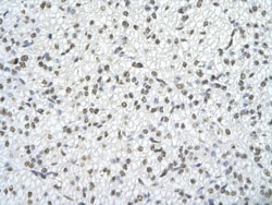 TRA2B Antibody, Novus Biologicals 0.1mg; Unlabeled:Antibodies, Polyclonal