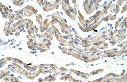 TRA2B Antibody, Novus Biologicals 100&mu;L; Unlabeled:Antibodies, Polyclonal