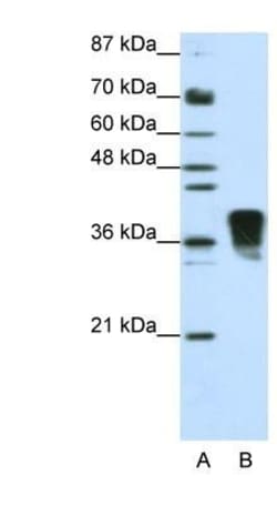 TRA2B Antibody, Novus Biologicals 0.1mg; Unlabeled:Antibodies, Polyclonal