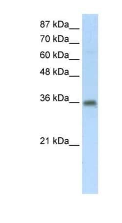 TRA2B Antibody, Novus Biologicals 100&mu;L; Unlabeled:Antibodies, Polyclonal