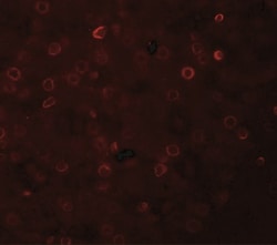 TRACP/PAP/ACP5 Antibody - BSA Free, Novus Biologicals:Antibodies:Primary