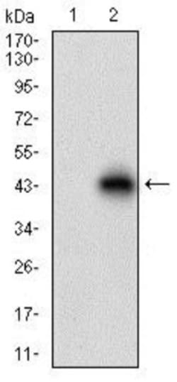 TRACP/PAP/ACP5 Antibody (7E6A11) - BSA Free, Novus Biologicals 0.1mL; Unlabeled:Antibodies,
