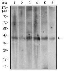 TRACP/PAP/ACP5 Antibody (7E6A11) - BSA Free, Novus Biologicals 0.1mL; Unlabeled:Antibodies,