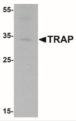 TRACP/PAP/ACP5 Antibody - BSA Free, Novus Biologicals:Antibodies:Primary