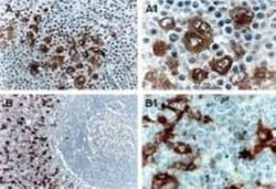 TRAF-1 Antibody, Novus Biologicals 0.025 mL | Buy Online | Novus Biologicals | Fisher Scientific