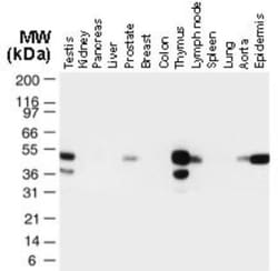 TRAF-1 Antibody, Novus Biologicals 0.025 mL | Buy Online | Novus Biologicals | Fisher Scientific