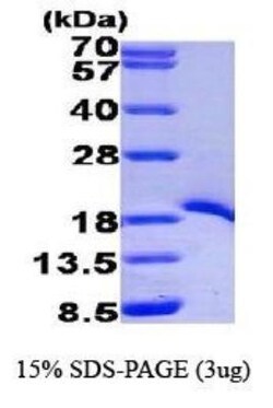 Novus Biologicals&trade;&nbsp;Recombinant Human TRAF-1 His Protein