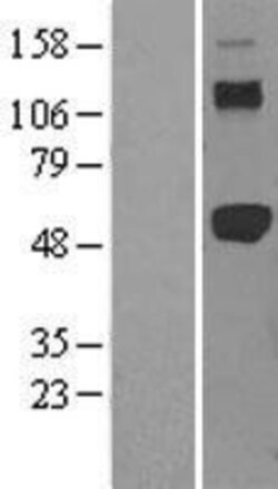 Novus Biologicals&trade;&nbsp;TRAF-2 Overexpression Lysate