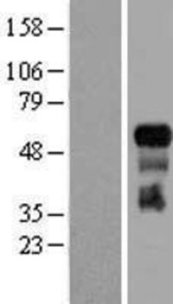 Novus Biologicals&trade;&nbsp;TRAF-3 Overexpression Lysate
