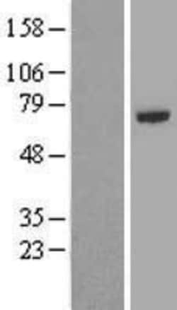 Novus Biologicals&trade;&nbsp;TRAF-5 Overexpression Lysate