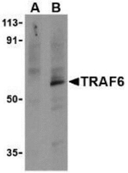 TRAF-6 Antibody, Novus Biologicals 0.1mg; Unlabeled:Antibodies, Polyclonal
