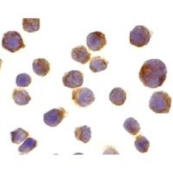 TRAILR1/TNFRSF10A Antibody - BSA Free, Novus Biologicals 0.1mg; Unlabeled:Antibodies,