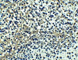 TRAILR1/TNFRSF10A Antibody - BSA Free, Novus Biologicals 0.1mg; Unlabeled:Antibodies,