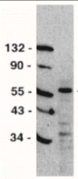 TRAILR1/TNFRSF10A Antibody - BSA Free, Novus Biologicals 0.1mg; Unlabeled:Antibodies,