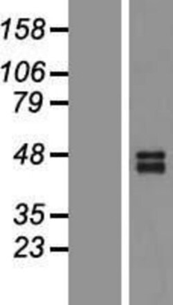 Novus Biologicals™ TRAILR2/TNFRSF10B Overexpression Lysate