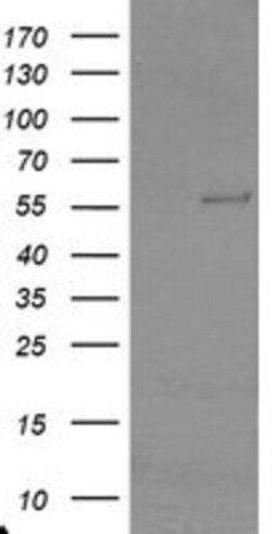 TRAIP Antibody (OTI2D4), Novus Biologicals 0.1 mL | Buy Online | Novus Biologicals | Fisher Scientific