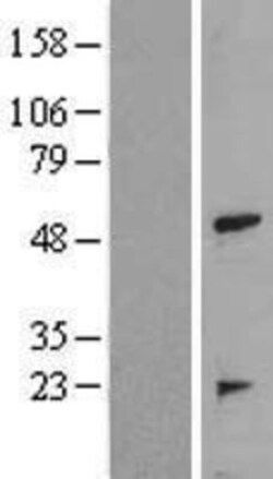 Novus Biologicals&trade;&nbsp;TRAIP Overexpression Lysate