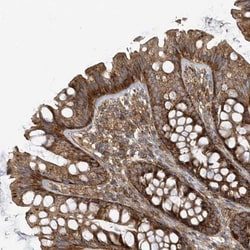 TRAIP Antibody, Novus Biologicals:Antibodies:Primary Antibodies