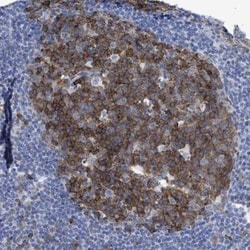 TR alpha/NR1A1/Thyroid Hormone Receptor alpha Antibody, Novus Biologicals