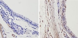 TR alpha/NR1A1/Thyroid Hormone Receptor alpha Antibody, Novus Biologicals:Antibodies:Primary