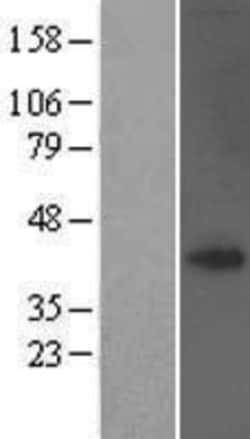 Novus Biologicals&trade;&nbsp;TRAM1 Overexpression Lysate