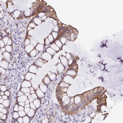 TRAM2 Antibody, Novus Biologicals 25 &mu;L, Unlabeled:Antibodies, Polyclonal