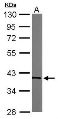 Transaldolase 1 Antibody, Novus Biologicals 0.1mL; Unlabeled:Antibodies,