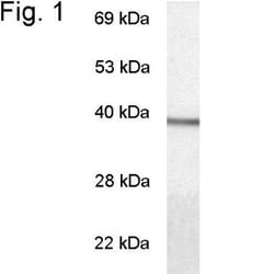 Transducin alpha Antibody - BSA Free, Novus Biologicals 0.1mg; Unlabeled:Antibodies,