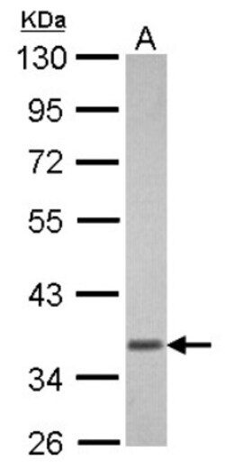 Transducin alpha Antibody, Novus Biologicals 0.1mL; Unlabeled:Antibodies,
