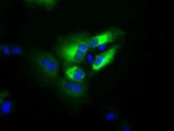 Transferrin Antibody (OTI5G2), Novus Biologicals 0.1mL; Unlabeled:Anticuerpos