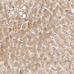 Transferrin Antibody, Novus Biologicals 0.1mL; Unlabeled:Antibodies, Polyclonal