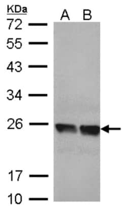 transgelin 2 Antibody, Novus Biologicals 0.1mL; Unlabeled:Antibodies, Polyclonal