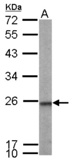 transgelin 2 Antibody, Novus Biologicals 0.1mL; Unlabeled:Antibodies, Polyclonal