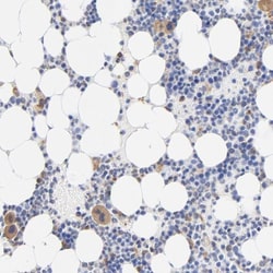 transgelin 2 Antibody, Novus Biologicals 0.1mL; Unlabeled:Antibodies, Polyclonal