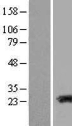 Novus Biologicals&trade;&nbsp;Transgelin-3 Overexpression Lysate