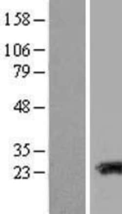 Novus Biologicals™ Transgelin-3 Overexpression Lysate